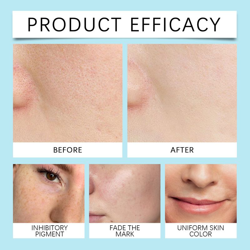 HOYGI Nicotinamidă Glicerină Temperatura Apei și Controlul Sebumului Hidratant Hrănitor Piele Moale Aplicare Umdă Toner Esență_voghion.com