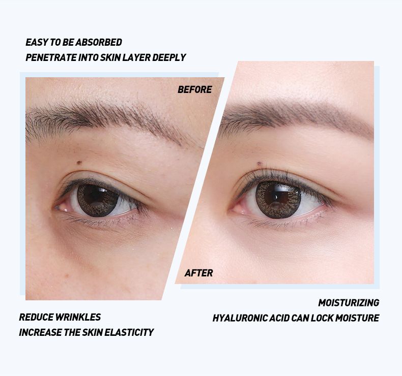 Creams Laike Yingrun Hydrating Eye Cream 30g Eye Care Hydrating Moisturizing Cosmetics Skin Care Products_voghion.com