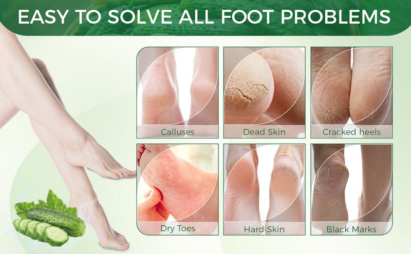 OUKEYA Cucumber Avocado Foot Mask Nawilżająca, Odżywcza - Głębokie Nawilżenie, Złuszczanie, Pielęgnacja Stóp Dla Suchych Popękanych Stóp_voghion.com