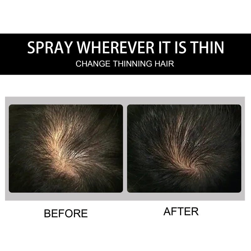 Cheratina Fibre per capelli Ispessimento Spray Crescita dei capelli Polvere Ricrescita Parrucca Per Donna Uomo Fibre per la costruzione dei capelli Perdita Produc_voghion.com