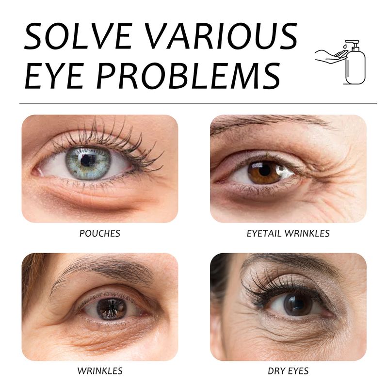 EELHOE Retinol Firming Eye Cream vermindert fijne lijntjes en kraaienpootjes, verzacht de huid rond de ogen, hydrateert en voorkomt_voghion.com