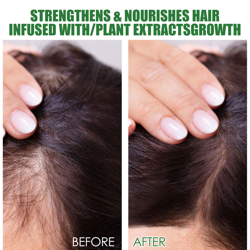 Rosemary Care, EELHOE Anti Drop Fixed Hair, dikke, sterke en hydraterende haarwortelcadeauset_voghion.com
