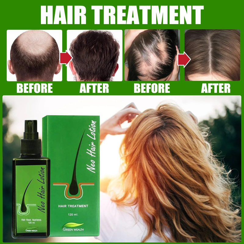 Growth Original Neo Uniex Anti Hair Lo Pilatory Natural Extract Baldne Lotion Eence Oil Repair Grow Spray tion_voghion.com