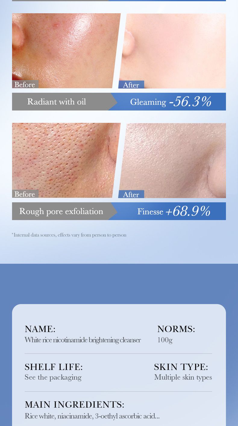 SADOER Aufhellendes Hautpflegeset mit weißem Reis und Niacinamid | Strahlende und hydratisierte Haut in 6 Schritten_voghion.com