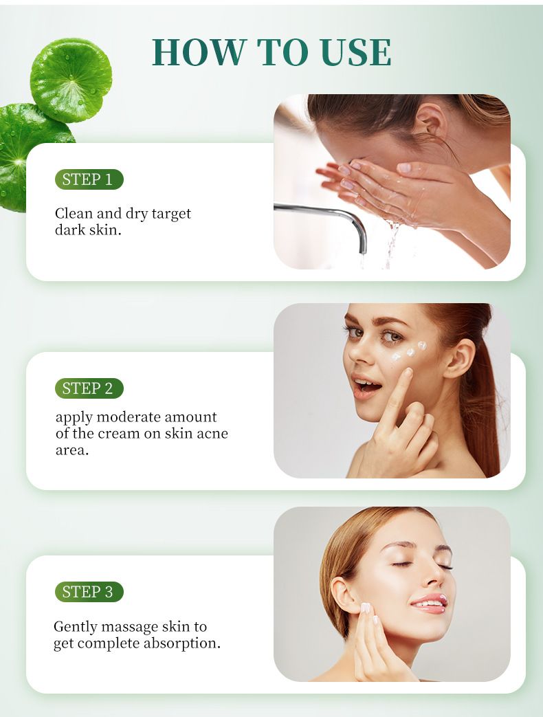 Treatments & Masks Anti Acne Facial Cream Moisturizing And Rejuvenating Acne Cream Facial Care_voghion.com
