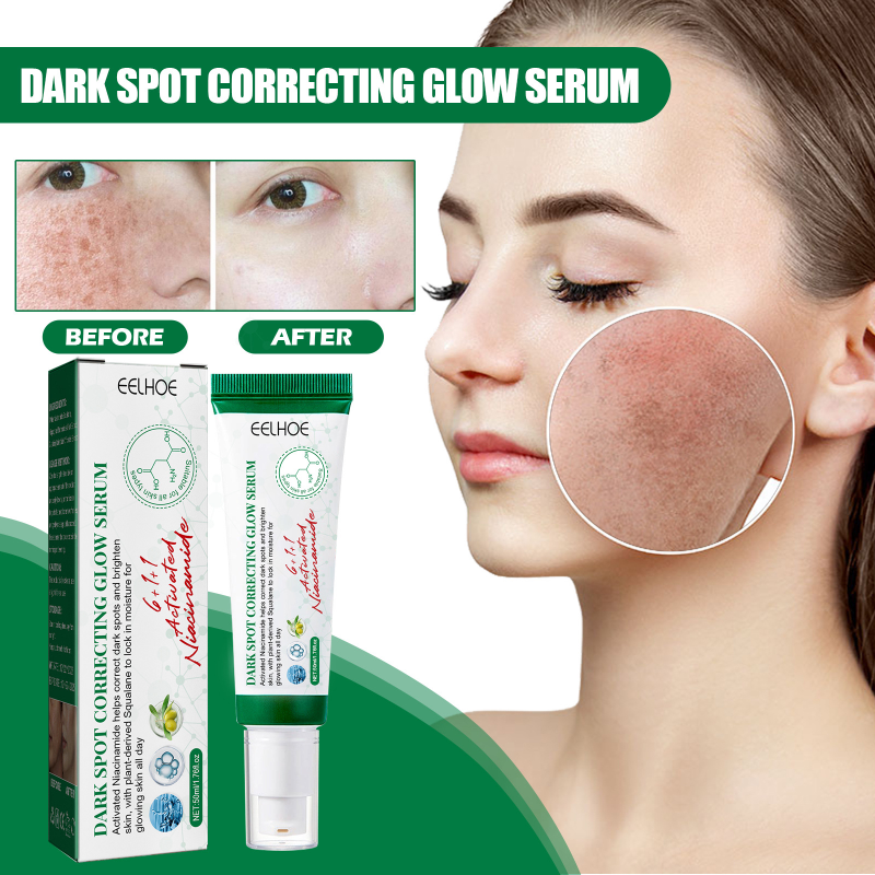 Sérum correcteur de taches sombres, 50ml, blanchissant, imperméable, éclaircissant, éclaircit et apaise_voghion.com