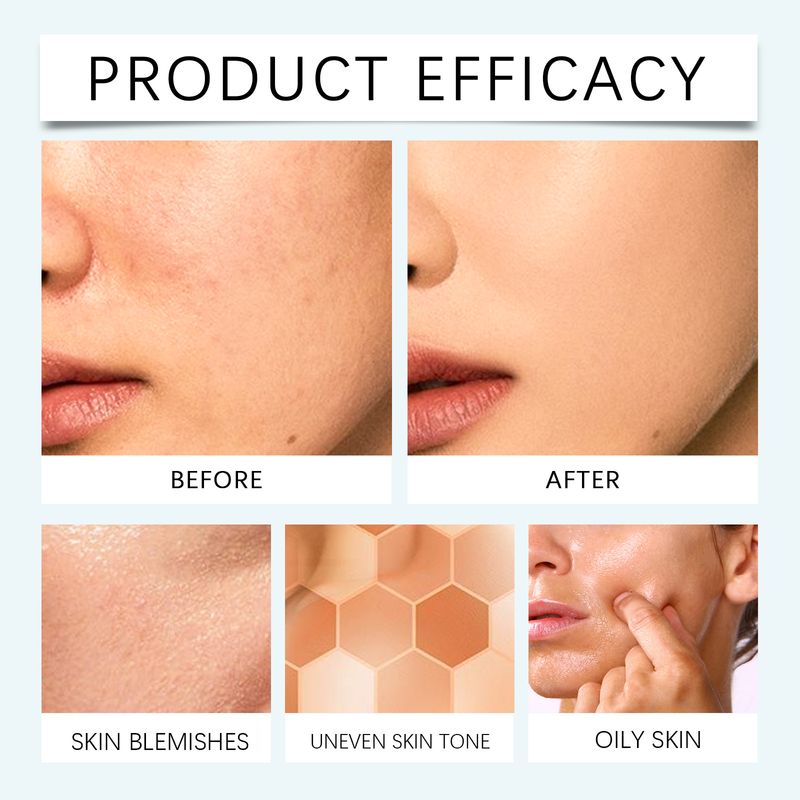EELHOE Medium Skin Covers Blemishes Is Dark, Natural, Light, Clear, Moisturizing, And Moisturizing. Concealer_voghion.com