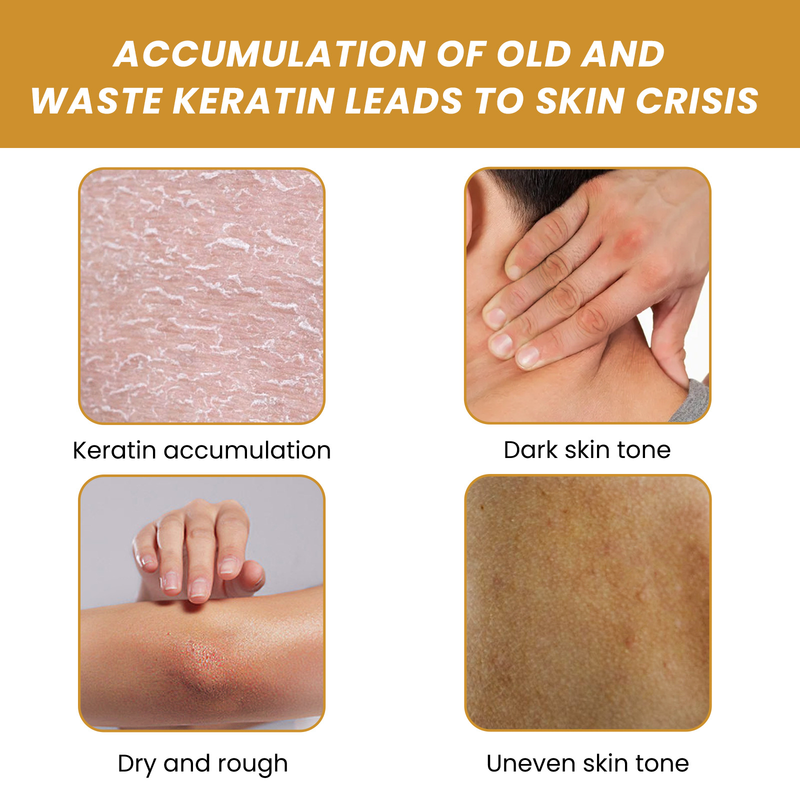 Peeling do ciała Usuwanie martwego naskórka Usuwanie ciemności Złuszczanie pleców Rozjaśnianie Kolana Łokcie Zwalczanie trądziku Głębokie oczyszczanie Nawilżanie Peelingi z kurkumą_voghion.com