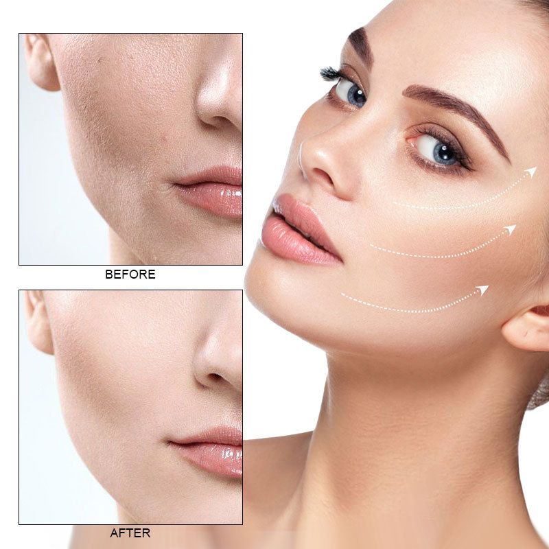 ROZINO Crema facial con vitamina C Loción hidratante reponedora para mujeres y hombres_voghion.com