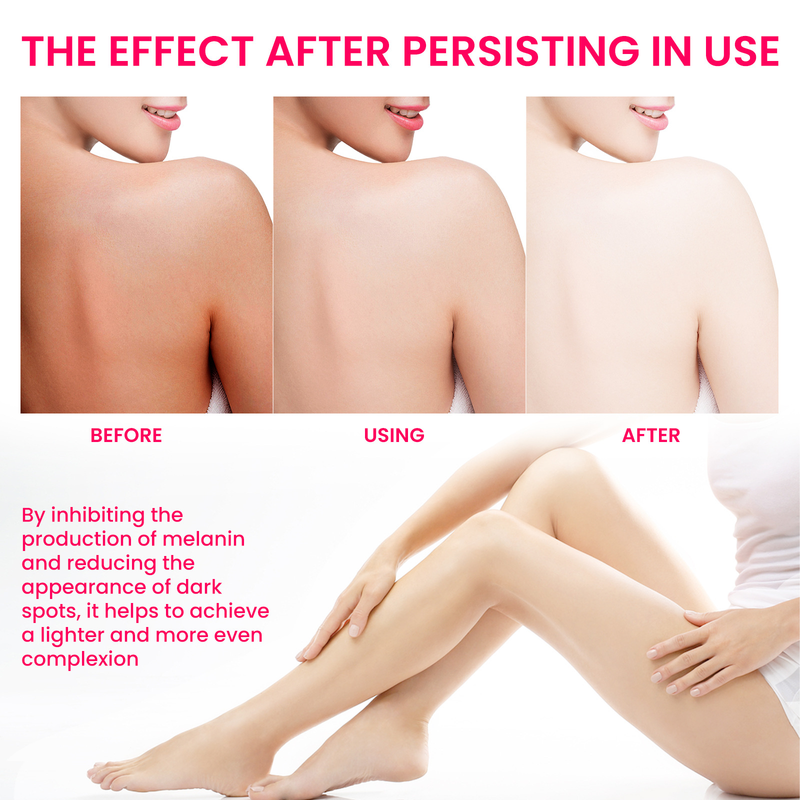 Women's Skin ELHOE Beautifying essen underarm joint brightening, whitening and lightening skin pigmentation care_voghion.com