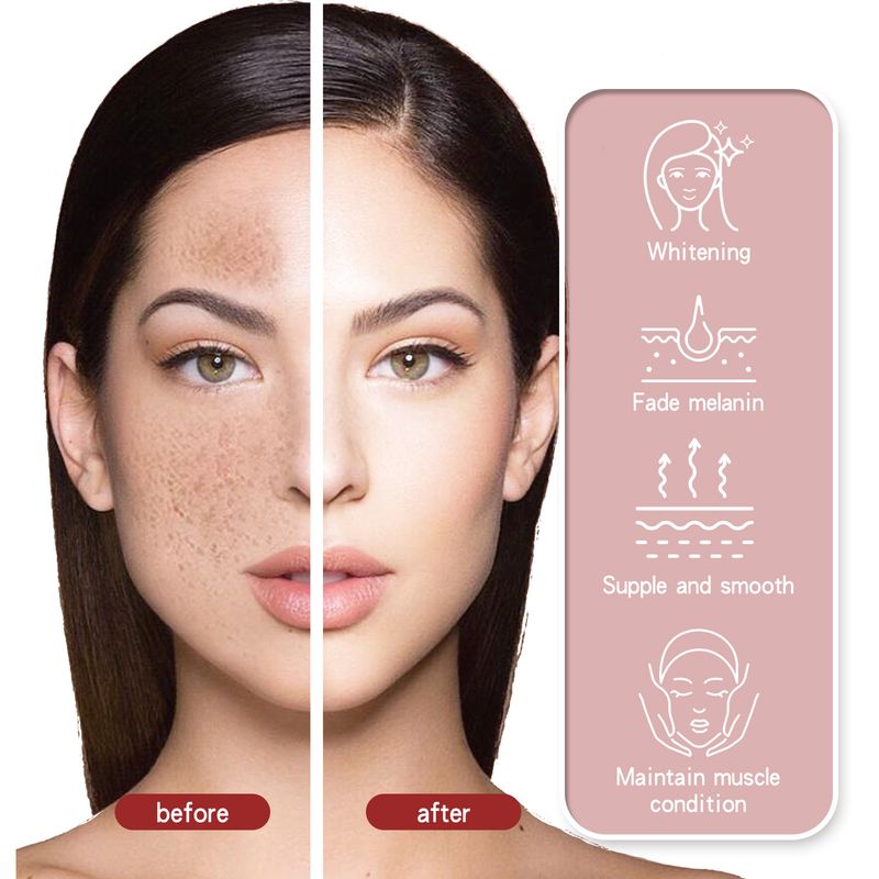 Crema blanqueadora de manchas EELHOE para reparar cicatrices de acné, reducir la opacidad, atenuar manchas, hidratar, nutrir y reafirmar._voghion.com