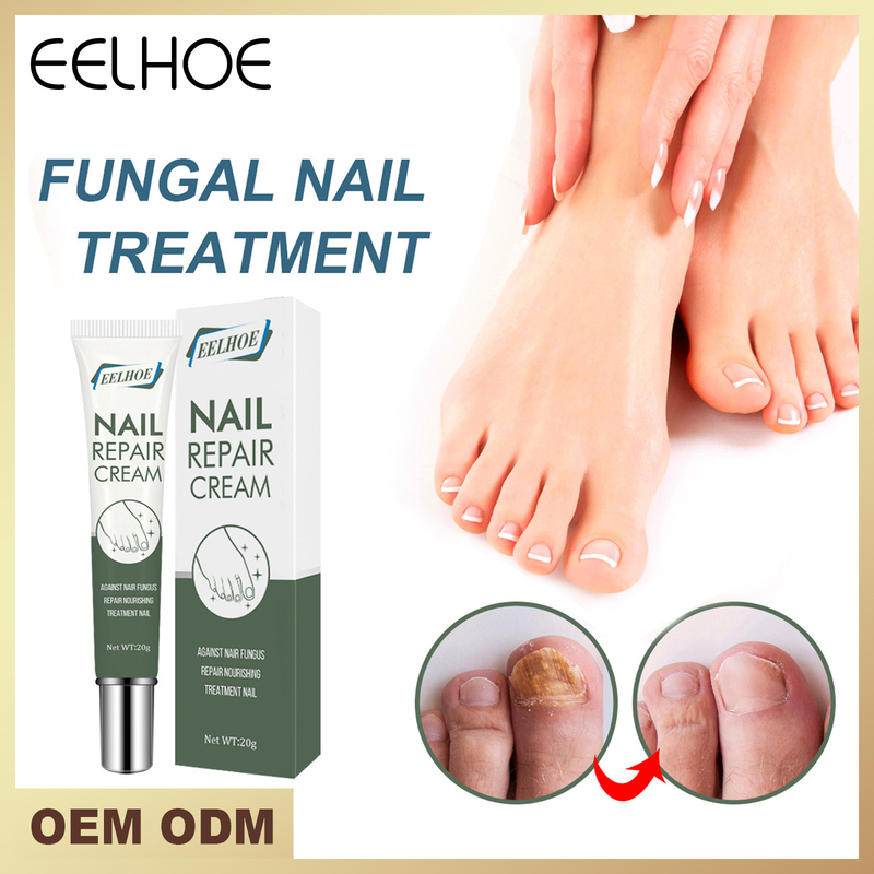 Eelhoe Fast removing polish repair care ointment Thickening nail cream gel_voghion.com