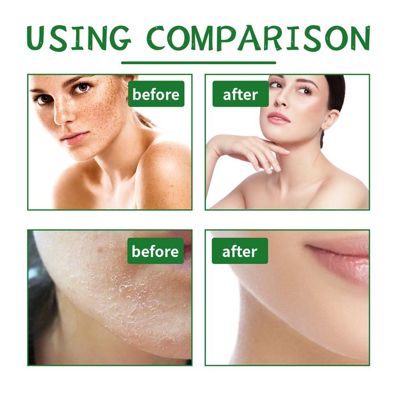 EELHOE Aloe Vera Scrub For Deep Cleansing, Exfoliating And Smoothing Acne Marks, Soft Skin Scrub_voghion.com