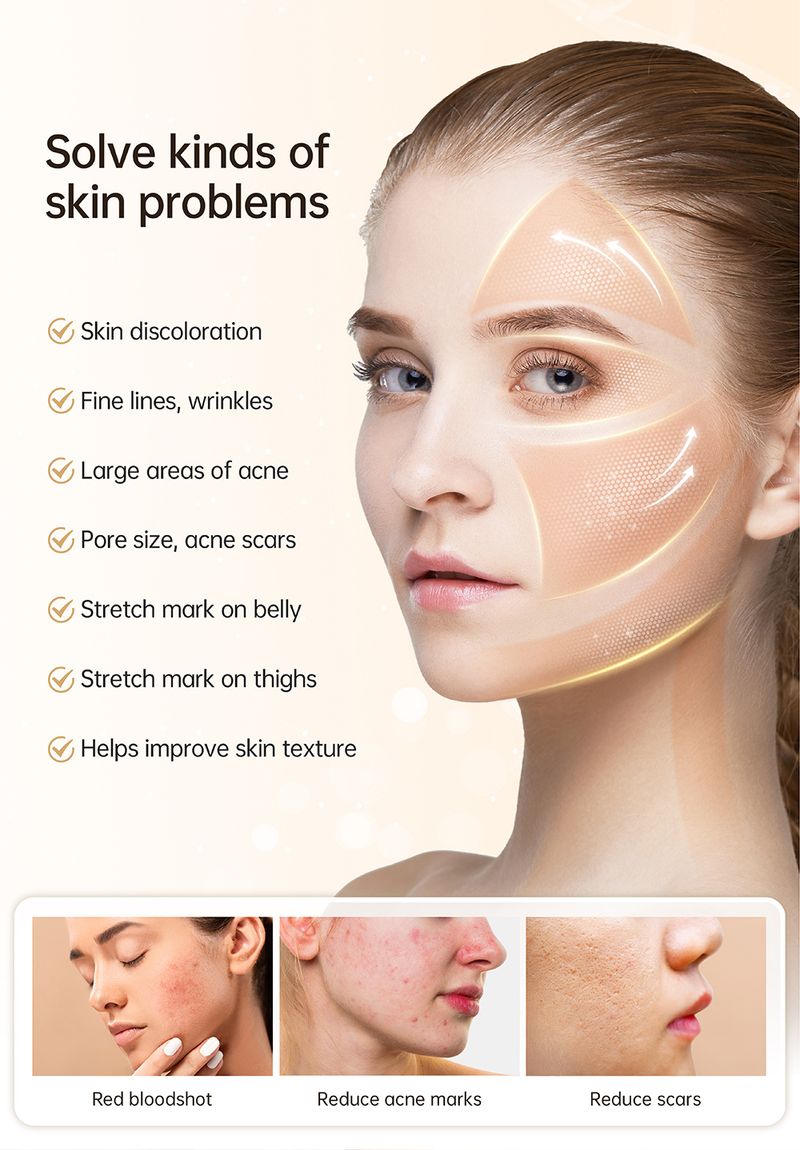 Oriģinālā Dr. Pen Hydra pildspalva H5 EMS Microneedling Pen_voghion.com