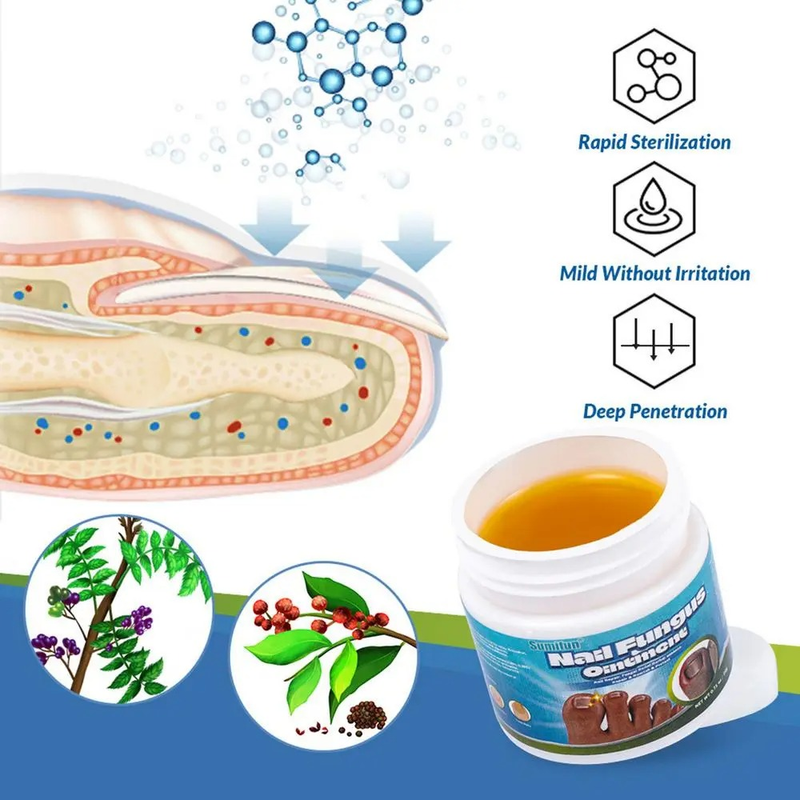 Nagelreparaturserum Salbe Onychomykose Paronychie Nagel Kräuter Zehennagel Fußreparatur Essenz Pflege Reparatur Trockenriss Fußpflege 20g_voghion.com