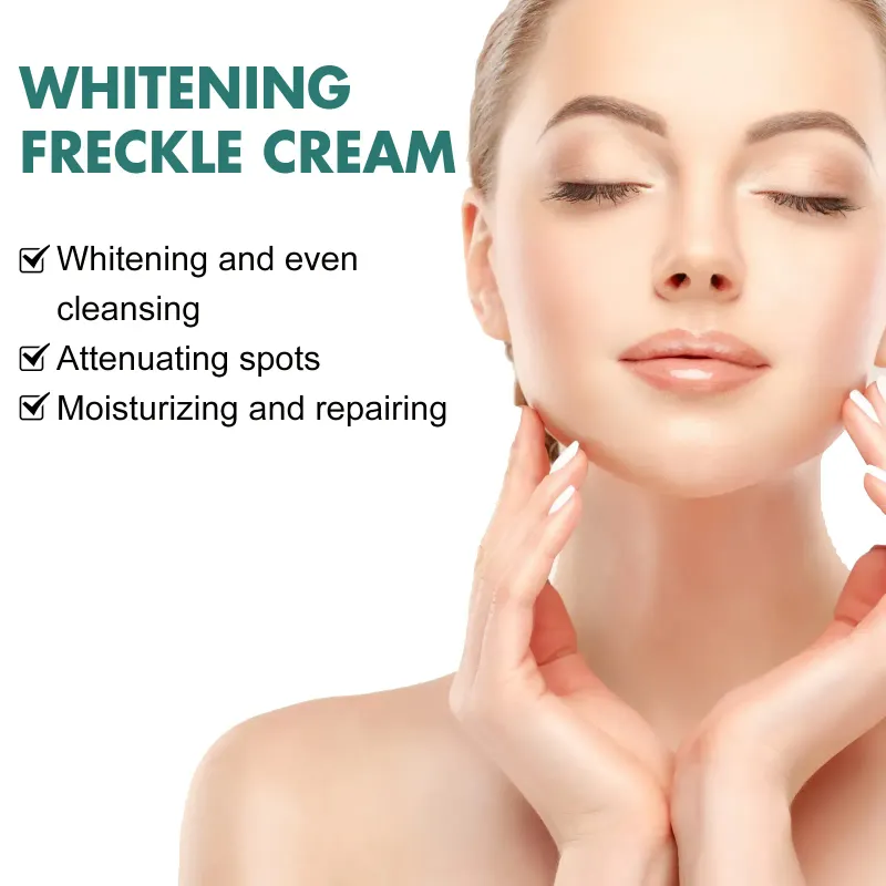 Niacinamid Melasma Brightening Cream Reducer Melanin Brighten Cream Lyser mørk hud Chloasma Serum Fade Fine ansigtslinjer_voghion.com