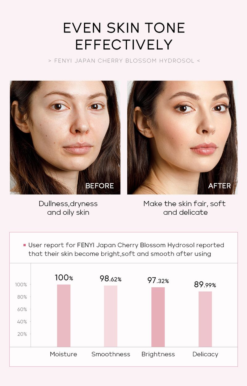 Fen Yi Japanese Cherry Blossom Pure Dew 100ml Hydrating Moisturizing Toner Facial Care Skin Care Products_voghion.com