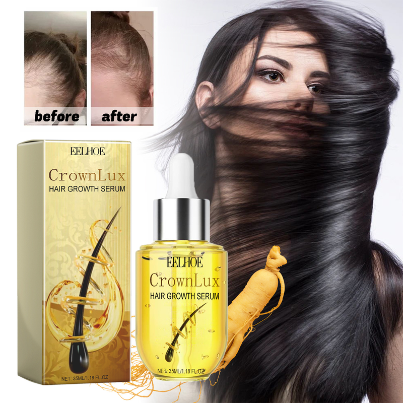 EELHOE Hair Dense Verhindert Haarausfall, pflegt das Haar, pflegt die Kopfhaut, pflegt dichtes Haar_voghion.com