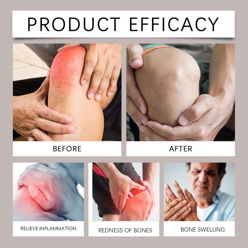 Joint Pain Care Cream For Joint, Knee, Elbow, Muscle And Bone Pain. Apply Moisturizing Care Cream Externally_voghion.com