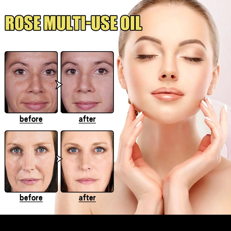 EELHOE Rosenblüten-Ätherisches Öl Befeuchtet Körperhaut, Pflegt Haar Und Verhindert Fußrissen – Ein Vielseitiges Pflegeöl_voghion.com