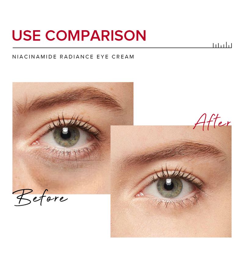 Creams LAIKOU PRO Niacinamide Revitalizing Eye Cream 20g Hydrating And Moisturizing Care For Eye Skin_voghion.com