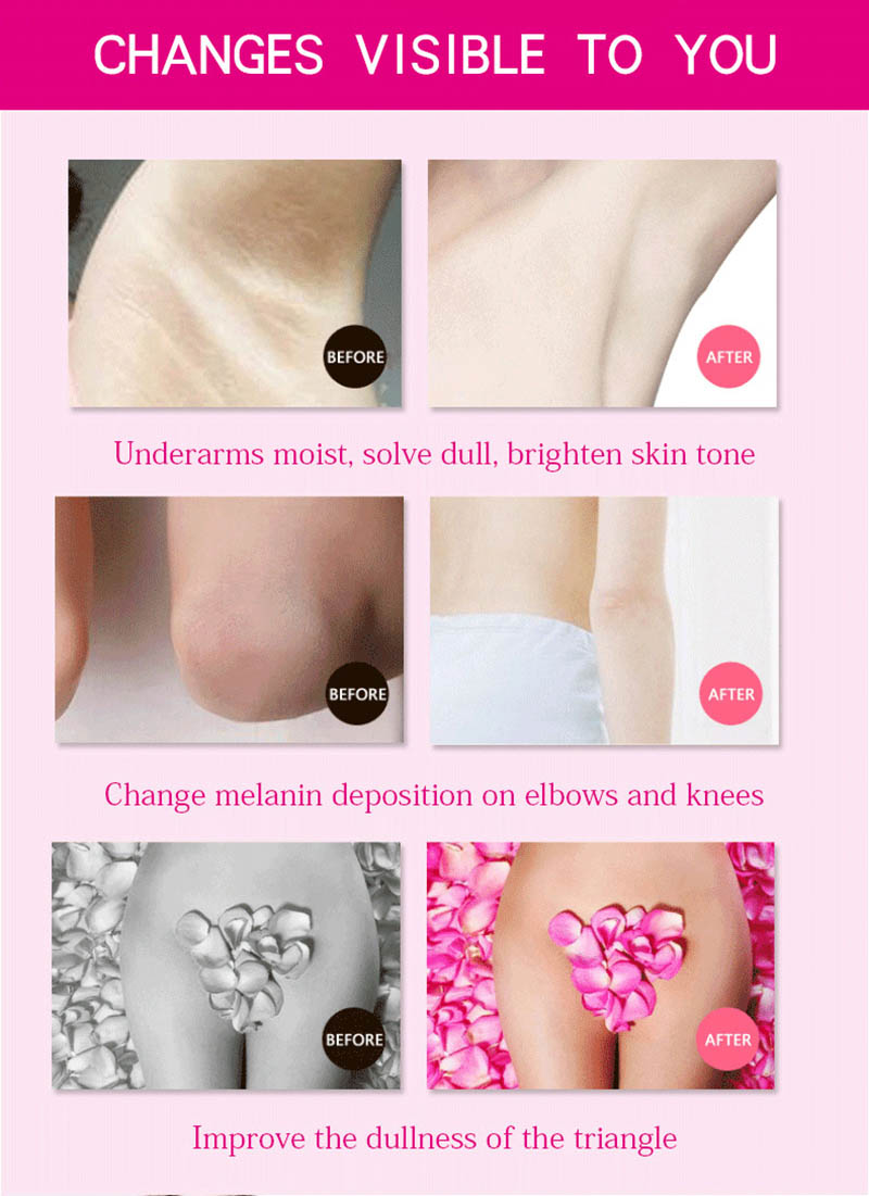 3Days Armpit Whitening Cream Skin Lightening Bleaching Cream For Underarm Dark Skin Legs Knees Whitening Intimate Body Lotion_voghion.com