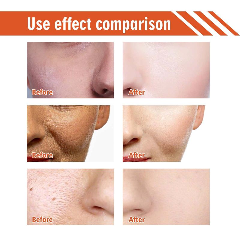 EELHOE Brightening&Rejuvenating Skin Essence Cream verlicht fijne lijntjes, vlekken, melanine, verheldert de huid, verfrist en_voghion.com
