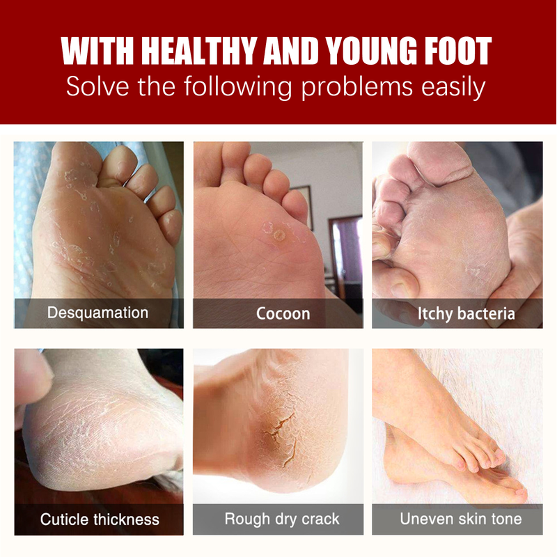 Jaysuing Exfolating Foot Mask, Tender Skin To Moist Calluses To Exfoliate Dead Skin Hydrating Foot Care_voghion.com