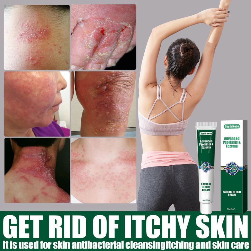 South Moon Skin Topical Cream Moisturizing and Moisturizing, Reducing Itching Herbal Ointment_voghion.com