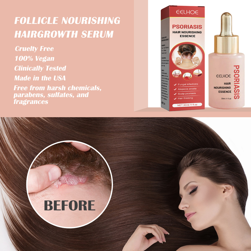 EELHOE Bovine Skin Moss Nourishing essence Deep Cleansing Scalp Removing Scurf Antipruritic Refreshing Dense H_voghion.com
