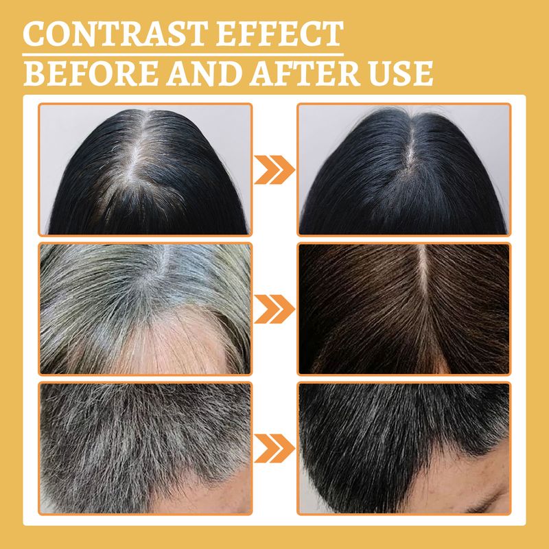 Reying Hair, Hair Darkening , Organic Ganoderma Nutrient Hair Reverse 30ML Black Ganoderma Nourishes Hair And Strengthens It_voghion.com