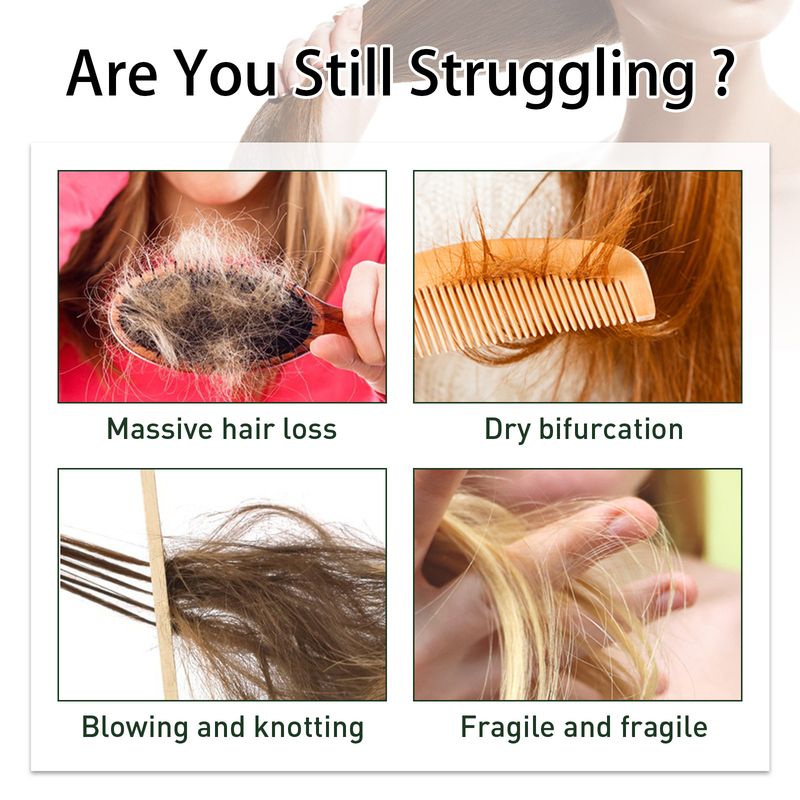 Essenza per capelli densa e rinforzante allo zenzero per la crescita dei capelli_voghion.com