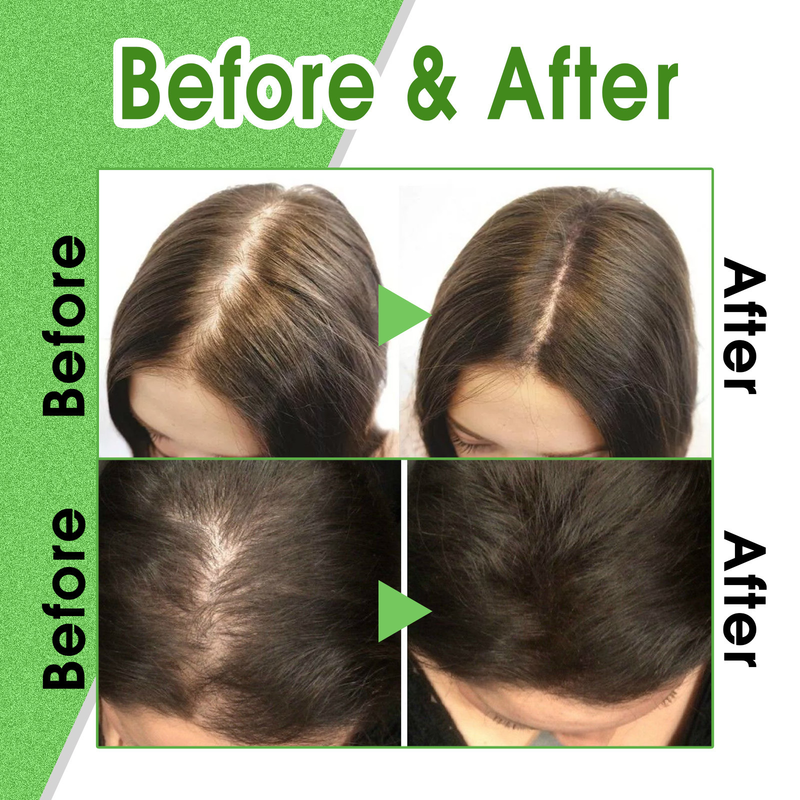 OUHOE Flüssige, nährende und reparierende Haarwurzeln, dicke Linie, Anti-Tropfen und fester Haarpflegeball_voghion.com