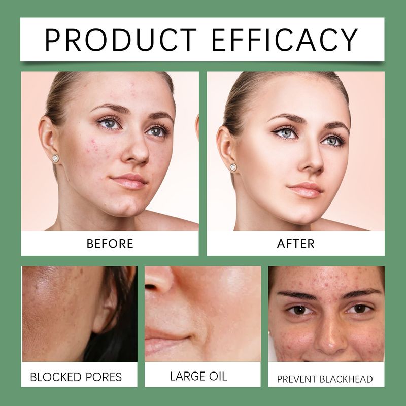 WEST MONTH Glycolic Acid Toner Water Temperature And Moisturizing Brightening Skin Refreshing Hydration_voghion.com