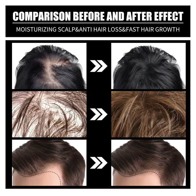 OUHOE Collagen B7 Vitamin Consolidate, Dense Prevent Broken Hair, and Protect Hair Essence Oil_voghion.com