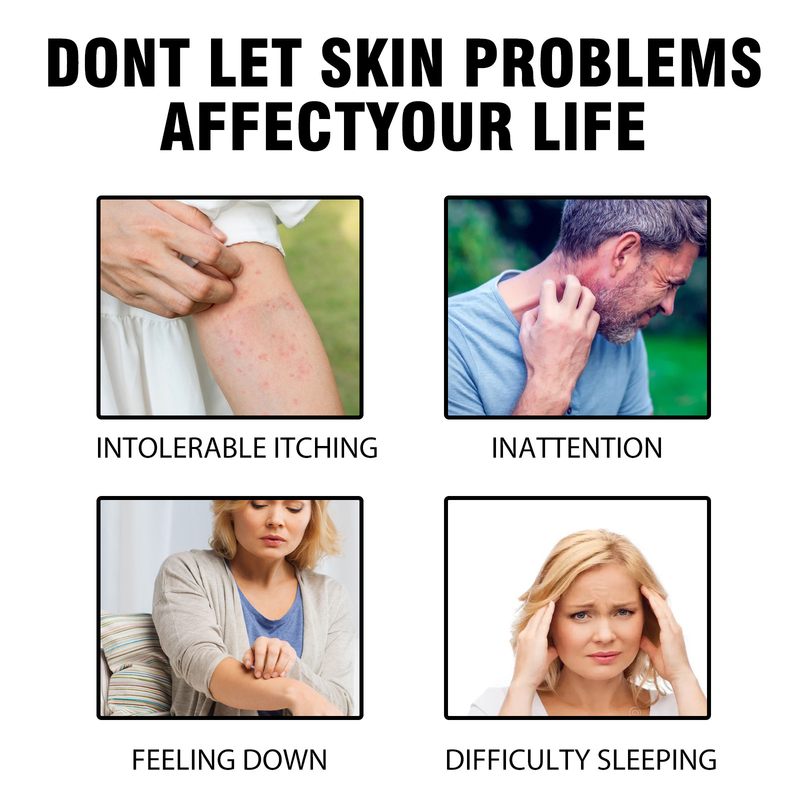 XIMONTH Repair Repairs redness itching of hands and feet Skin Care spray_voghion.com