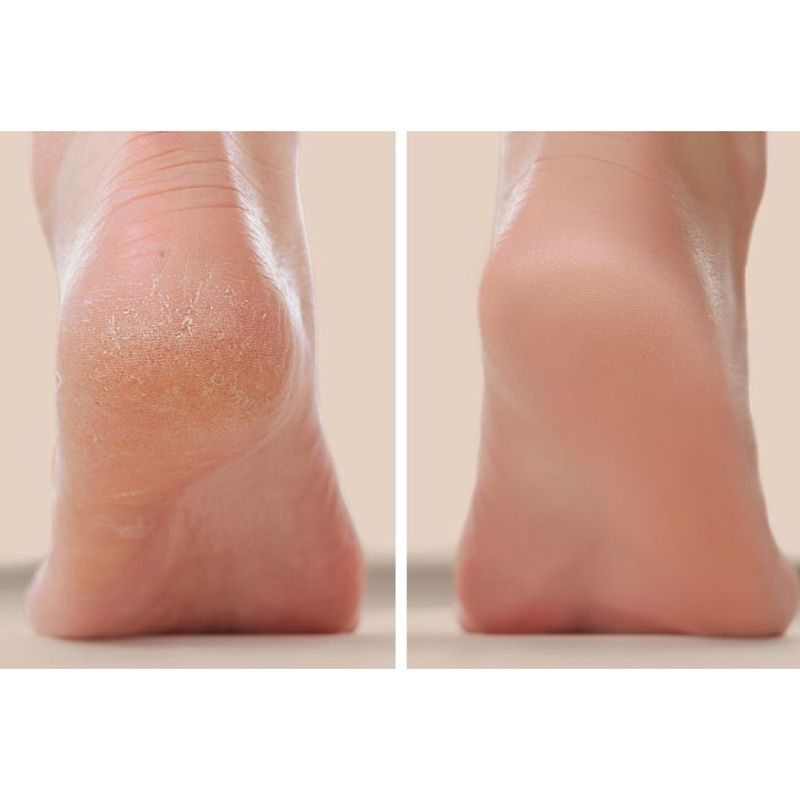 New File Multi-Functional Electric Foot Remover Fully Automatic Dead Skin Callus Grinder Nail Salon_voghion.com