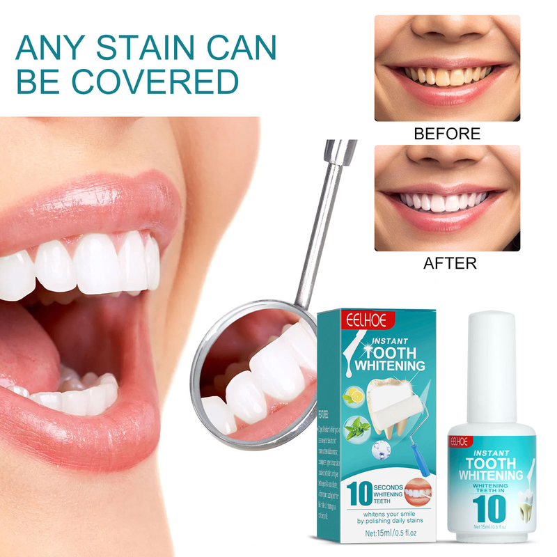 Tooth Whitening Stains Stains, Preventing Pigment Deposition, Cleaning Oral Odors, and Caring for Teeth Paint_voghion.com