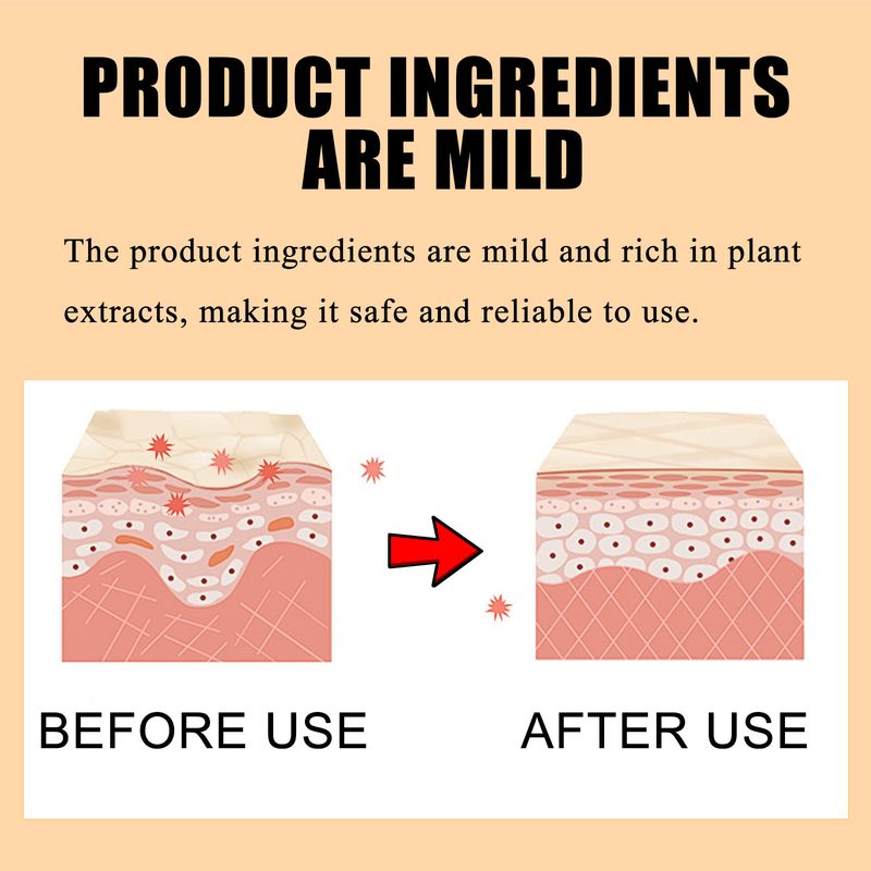 2025 Men's Relieving Dry Reddened Body, Moisturizing Skin, And Cleaning Body Care Cream_voghion.com