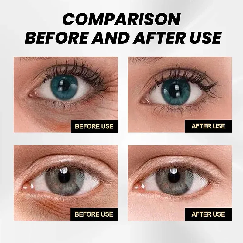 Retinol Anti-Puffiness Eye Cream Instant Tighten Remove Dark Circle Crow's Feet Collagen Anti-Aging Firm Smooth Eye moisturizing_voghion.com