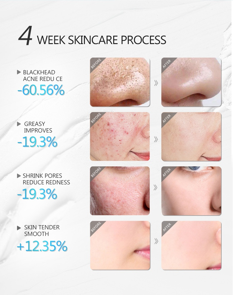 AuQuest Cleaning deterge delicatamente la maschera di fango all'acido salicilico per l'applicazione del viso_voghion.com