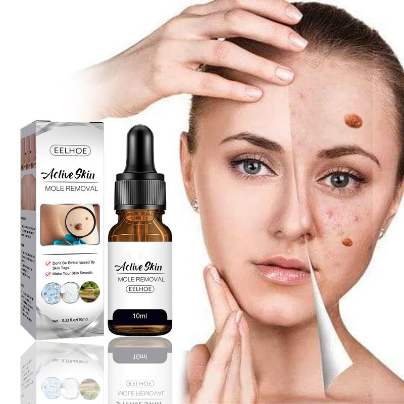 10 ml Behandlung zur Hühneraugenentfernung, tiefes Eindringen, gesunde, multifunktionale Essenz zur Entfernung von Hautmalen für Mädchen_voghion.com