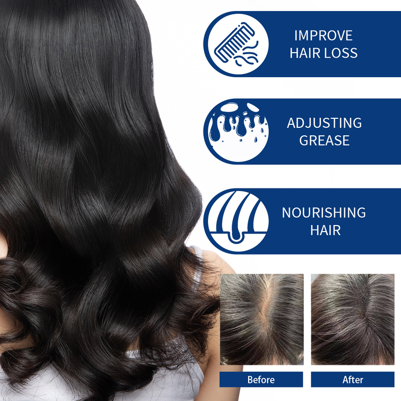 EELHOE Crema Detergente Scrub per Capelli per la forfora del cuoio capelluto, allevia il prurito, soffice, idratante, capelli densi, fissazione dei capelli,_voghion.com