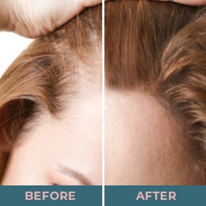 VITAL NUTRITIVE Vital Complex Βιοτίνη Βιταμίνη Β Ανδρικά Γυναικεία Βιταμίνες Υγιή μαλλιά, δέρμα, νύχια Χωρίς ορμόνες, χωρίς γλουτένη_voghion.com