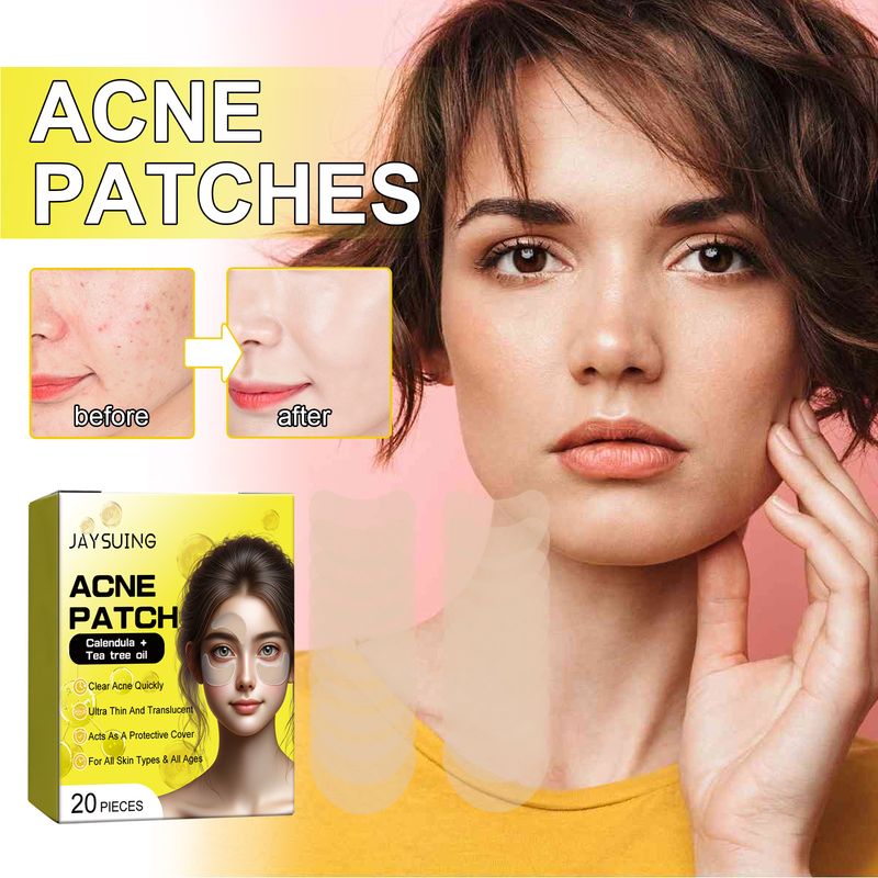 Jaysuing Acne Hydrocolloid Patch For Cleansing Facial Acne, Closing Mouth And Removing Blackheads Delicate Skin Patch_voghion.com