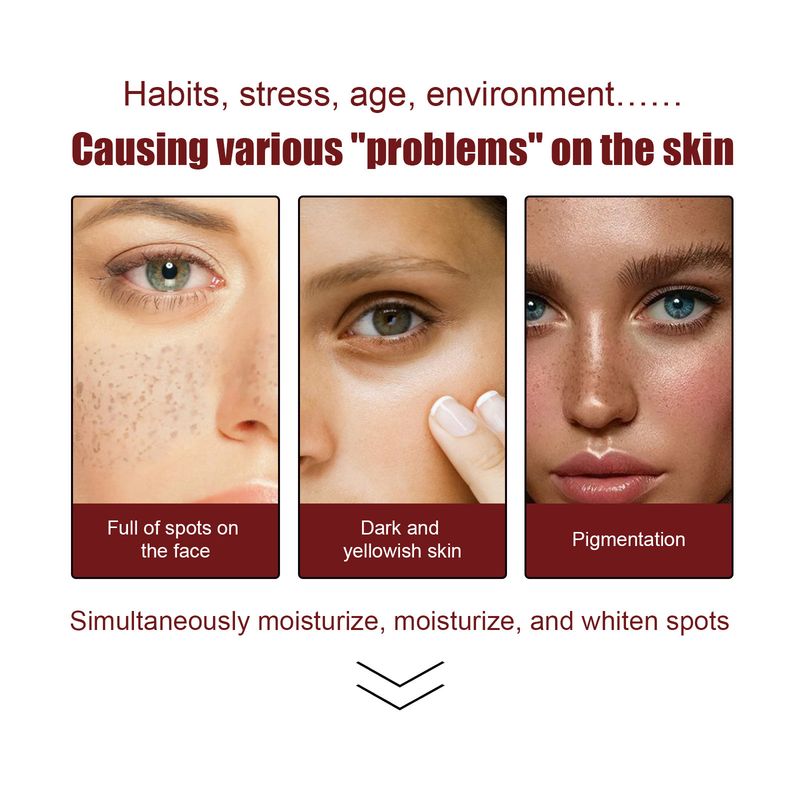 EELHOE Whitening Spotting Cream Spotting, Softening And Moisturizing Care, Brightening Skin Tone_voghion.com