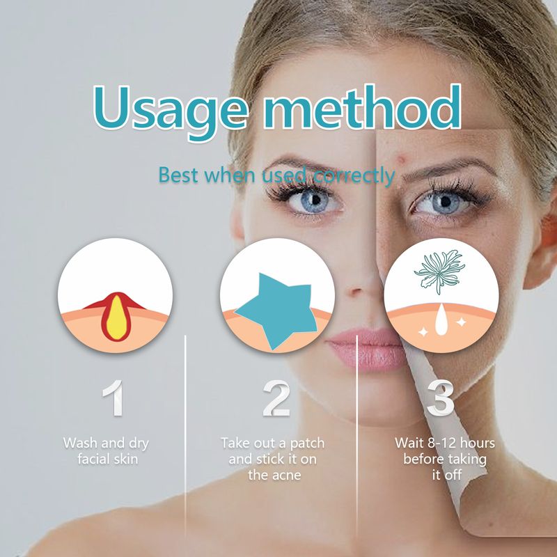 Hidrokolloid pattanásmatrica, pattanástisztító, lélegző korrektor matrica_voghion.com