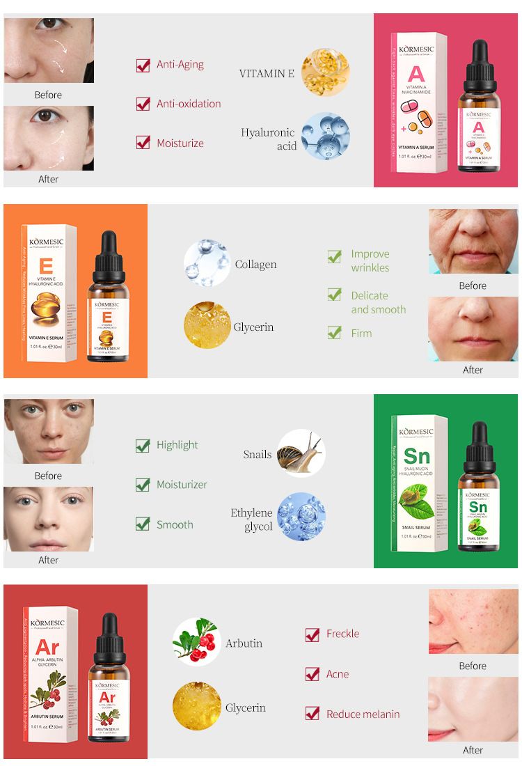 KORMESIC Serum Hydrating And Moisturizing Skin Facial 30g_voghion.com