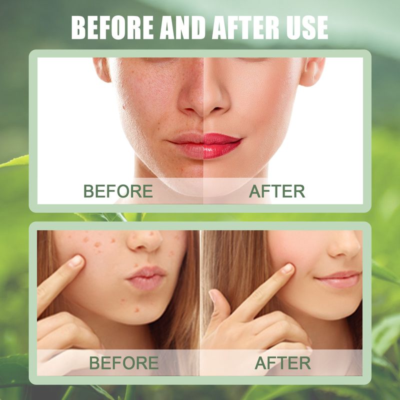 Máscara de Chá Verde, Bastão de Limpeza Facial, Hidratante, Limpeza Profunda, Removedor de Poros, Cravos, Máscara Facial, Controle de Oleosidade, Cosméticos e Maquiagem_voghion.com