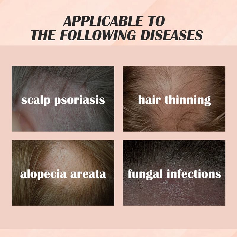 EELHOE Hair Nourishing Essence Daily Clean Scalp Dandruff Refreshing Oil Control Moisturizing Care Soft And Beautiful_voghion.com